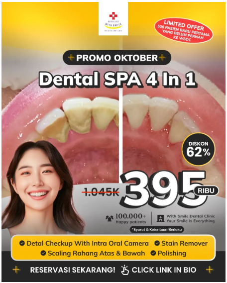 Promo kode kontak kami 